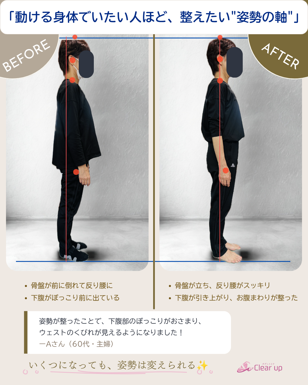 ビフォーアフター3